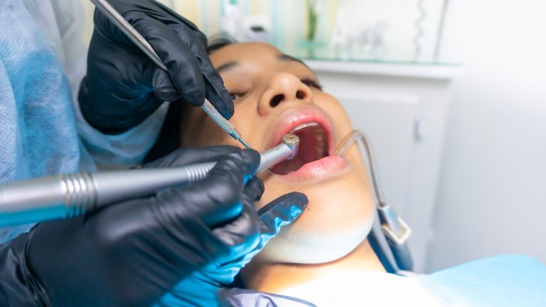 7 Key Factors to Consider When Choosing a Teeth Whitening System